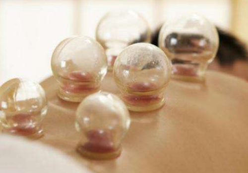 拔火罐能拔出毒素吗